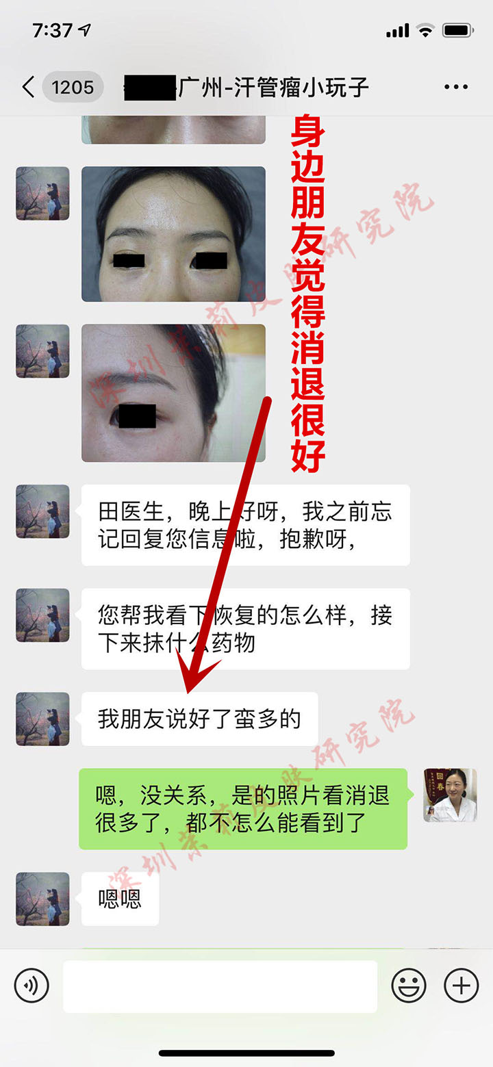 汗管瘤患者的聊天记录 7-8月学生教师优惠季开始啦,去掉讨厌的汗管瘤(图10)