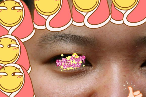 汗管瘤治疗后两个多月的样子 汗管瘤治疗后两个多月的样子