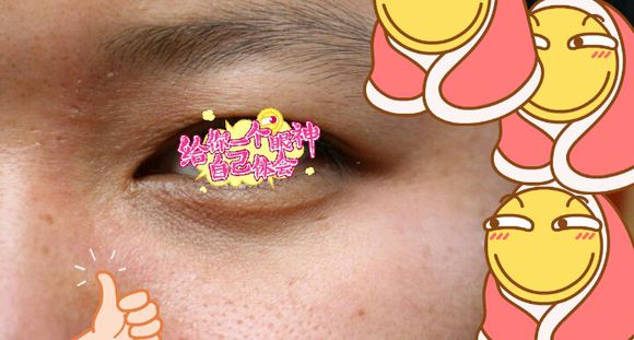 汗管瘤治疗后两个多月的样子 汗管瘤治疗后两个多月的样子