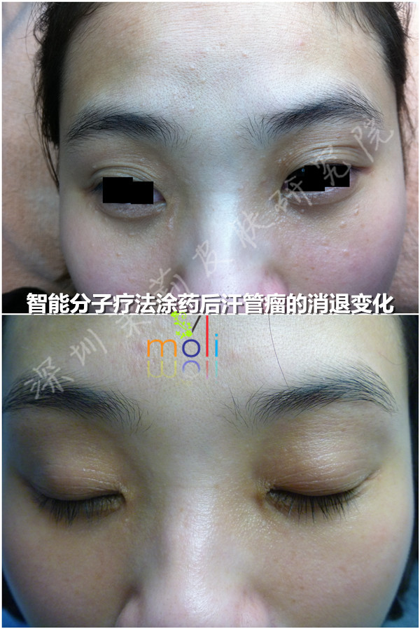 智能分子疗法 智能分子疗法