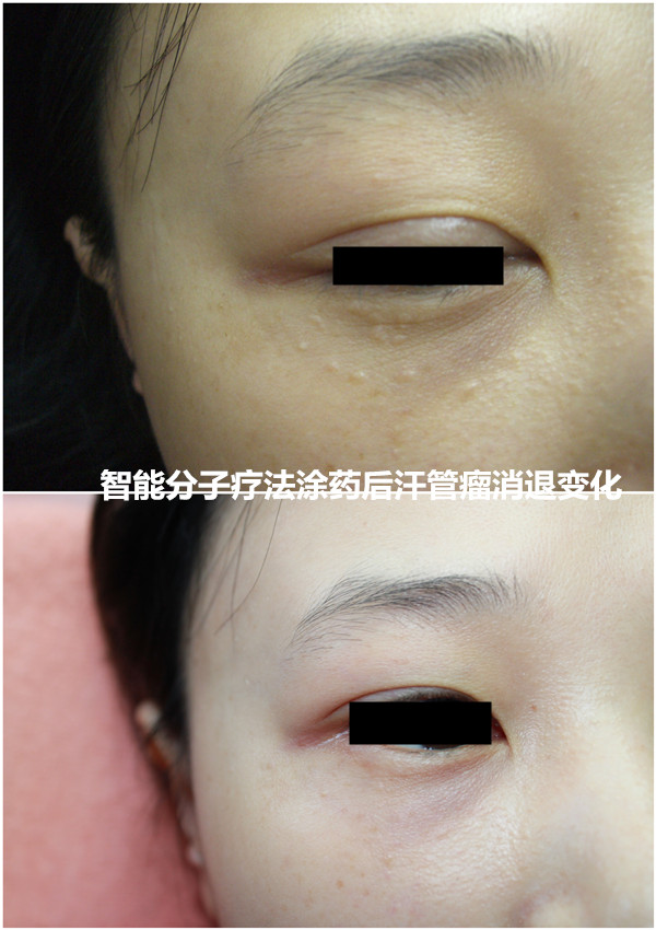 智能分子疗法 智能分子疗法