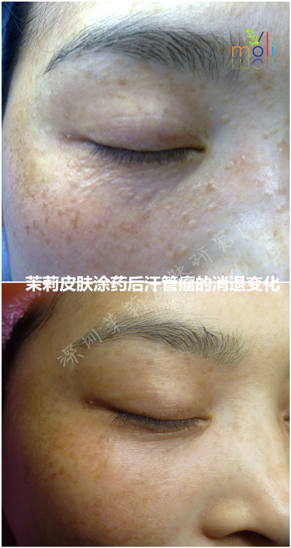 智能分子疗法 智能分子疗法