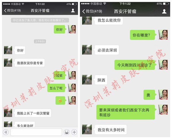 经常晒会加深汗管瘤颜色吗?(图1) 经常晒会加深汗管瘤颜色吗?(图1)