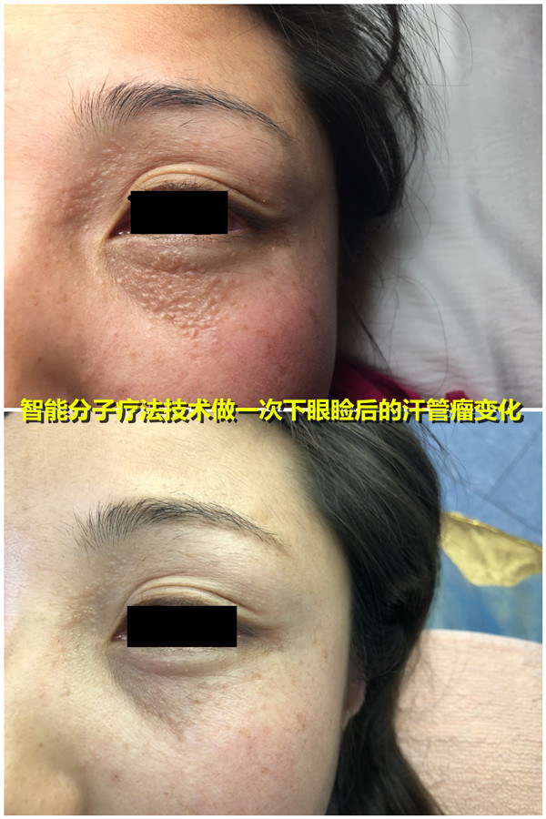 智能分子疗法技术 智能分子疗法技术