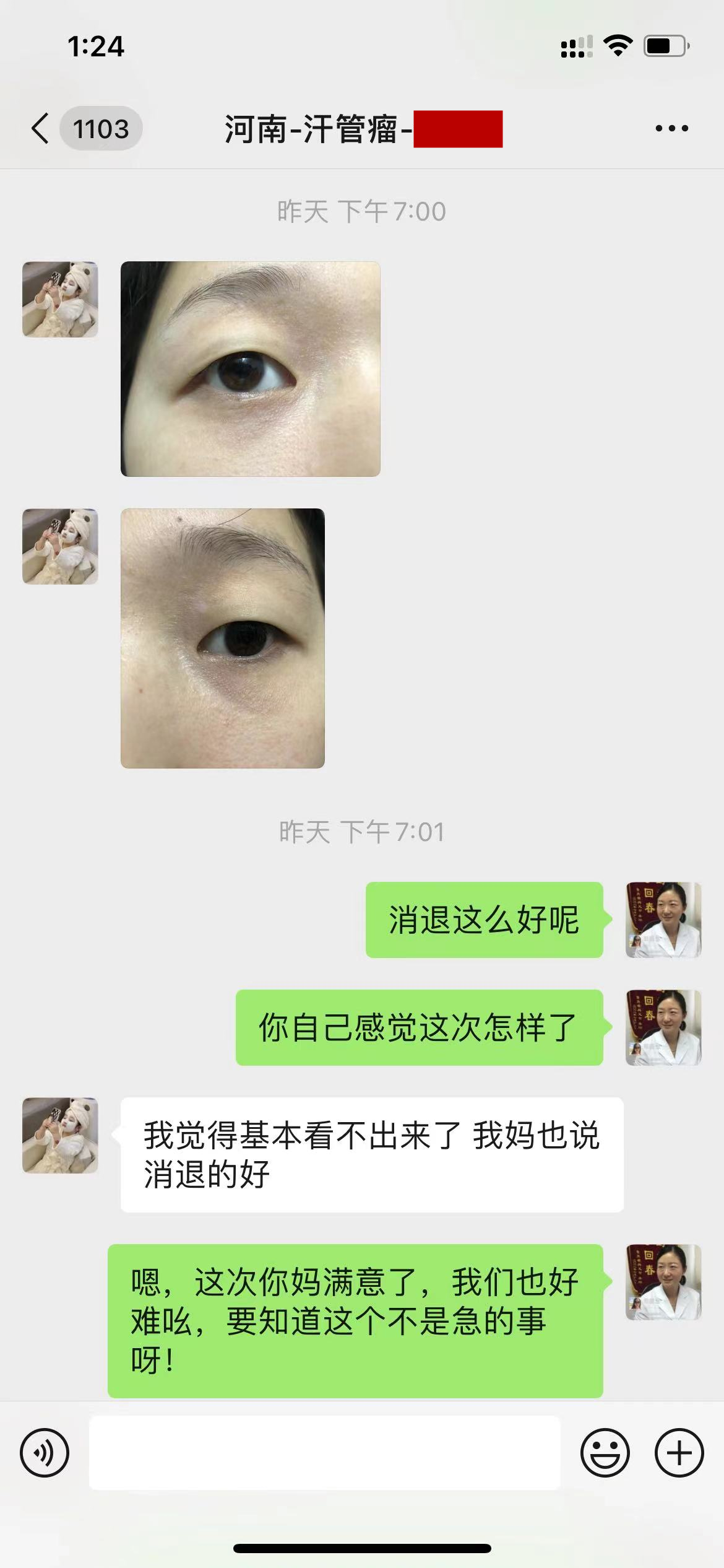 河南16岁女生脸上汗管瘤消退下去,幸好她没有听妈妈的话(图2) 河南16岁女生脸上汗管瘤消退下去,幸好她没有听妈妈的话(图2)