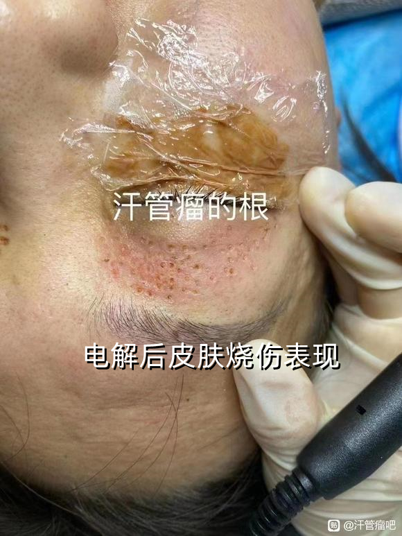 茉莉5月外巡广东、广西、湖南、贵州、四川开始预约(图2)