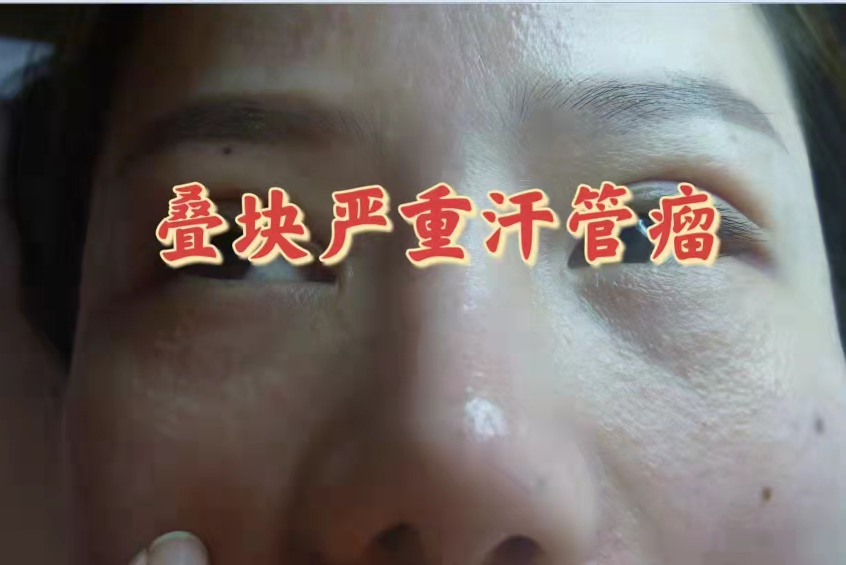 茉莉7月外巡火爆预约(图2)